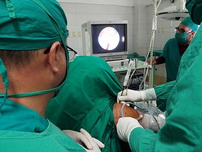 Cirujano suizo lidera en Camagüey operación de hombro con técnica de artroscopia