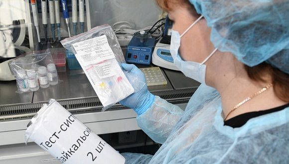Una empleada sostiene un kit de reactivos para la detección del coronavirus desarrollado por el centro Vector, en Chitá (Rusia), el 2 de febrero de 2020. Foto: Sputnik.