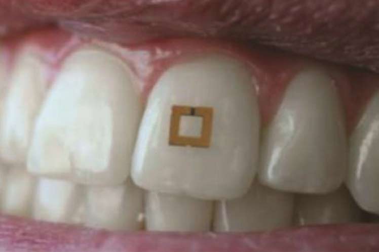 Dentadura con sensor