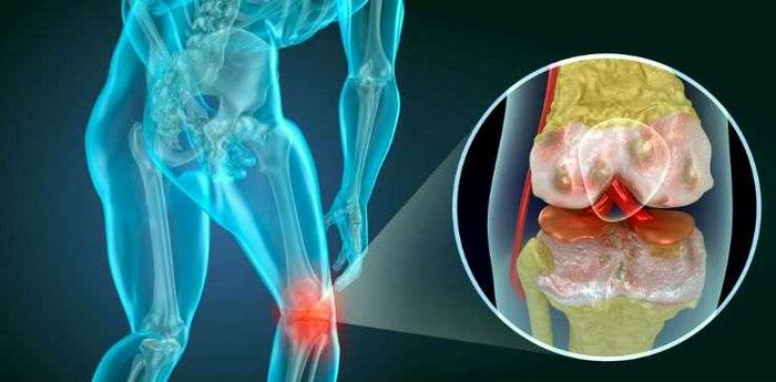 ¿Qué hacer cuando duelen las rodillas? ¿Qué hacer cuando duelen las rodillas?