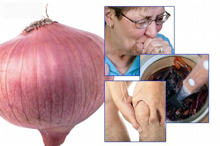 La cebolla reduce los síntomas de fatiga, ansiedad y depresión