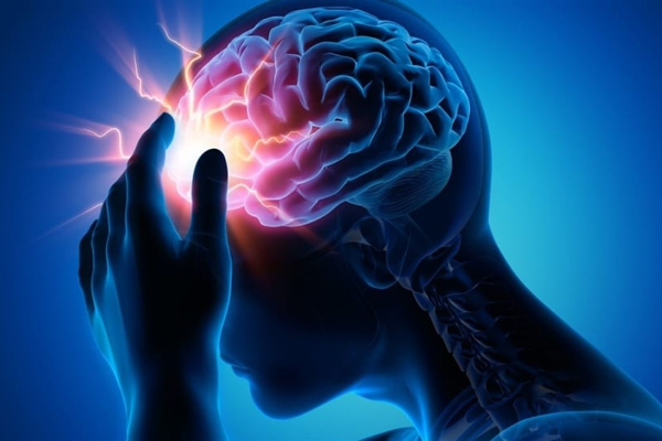 Epilepsias y dolor de cabeza
