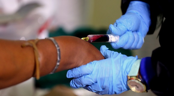 Cuba en busca del riesgo genético ante la COVID-19