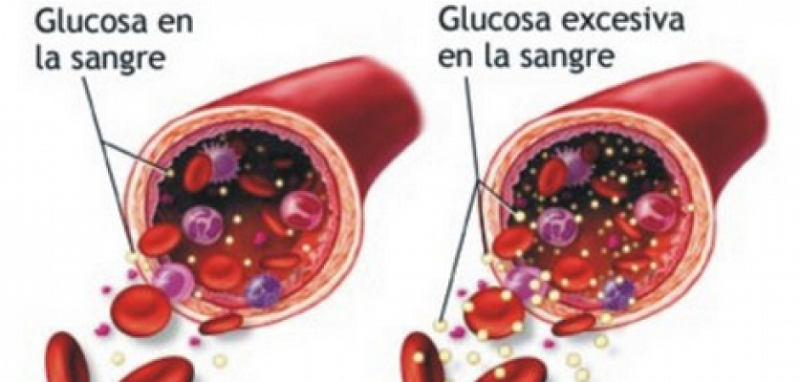 Qué es la diabetes y qué es la glicemia