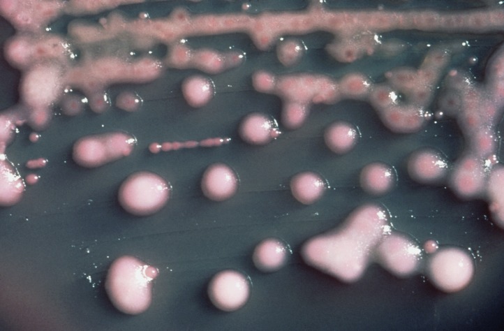 Estos son cinco de los aterradores tipos de bacterias más resistentes a los antibióticos en los últimos años